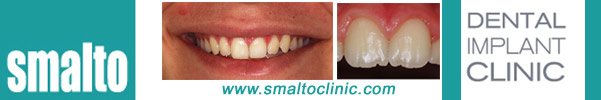 http://www.smaltoclinic.com